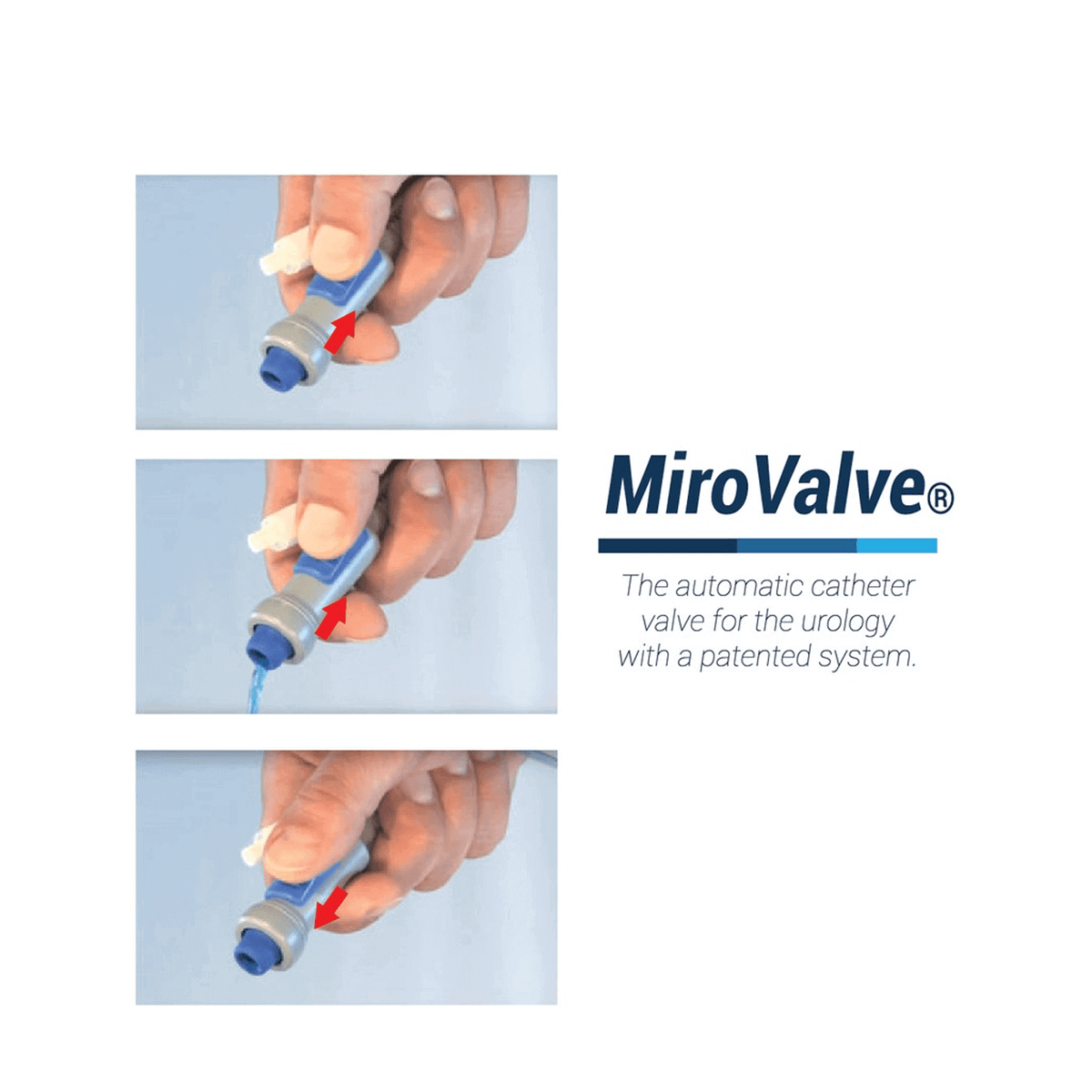 Miro Valve Sterile Automatic Urology Valve